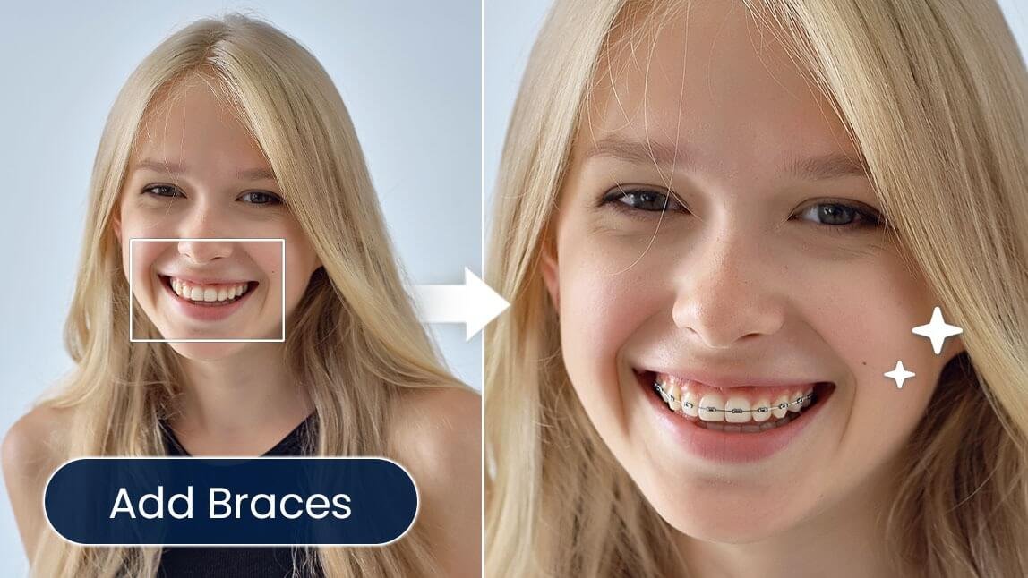 Braces Filter: What Would I Look Like with Braces (Online & App)